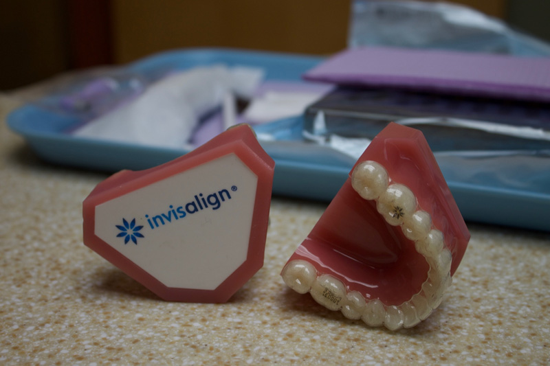 Invisalign in Indianapolis